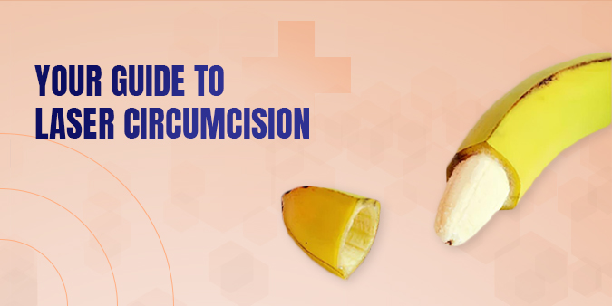 Your Guide to Laser Circumcision: Process, Benefits, and Recovery